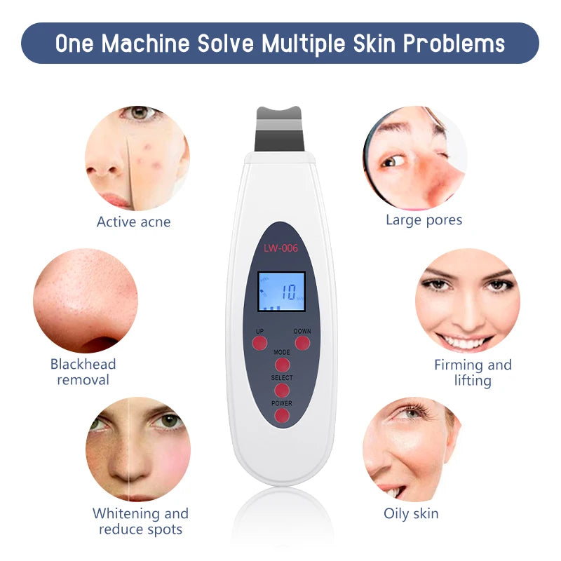 Ultrasonic Skin Scrubber | Deep Cleansing & Blackhead Remover Facial Lifting Device LW006