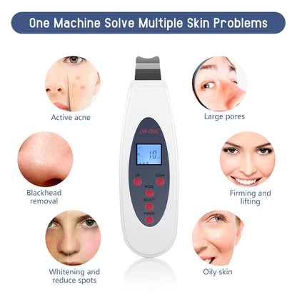 Ultrasonic Skin Scrubber | Deep Cleansing & Blackhead Remover Facial Lifting Device LW006