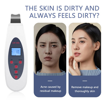 Ultrasonic Skin Scrubber | Deep Cleansing & Blackhead Remover Facial Lifting Device LW006